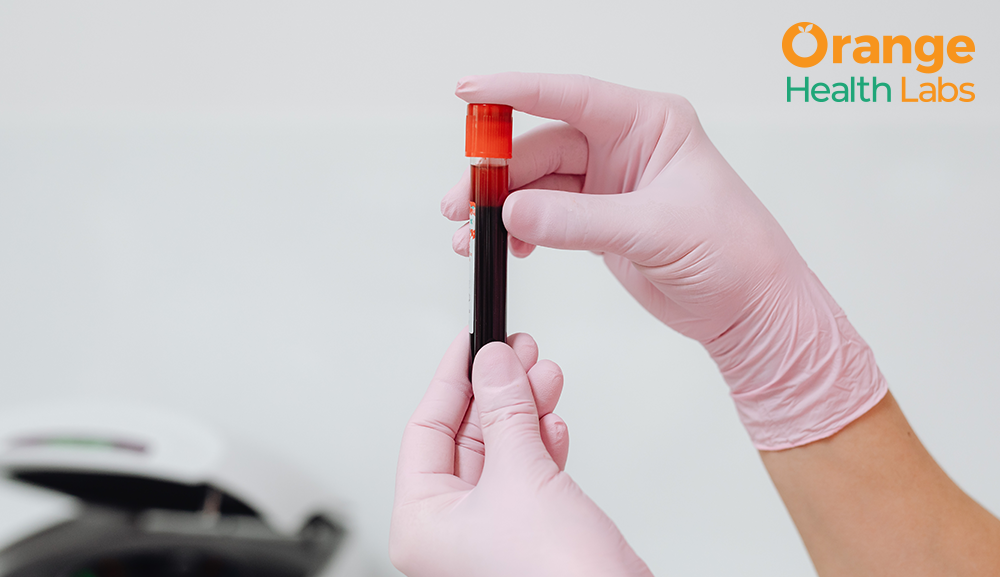 What Is Blood Routine Examination & What Are the Benefits of Regular Blood Tests?