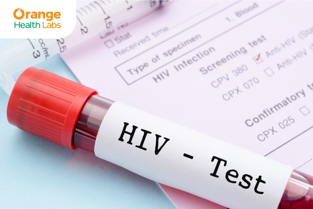 The Role of HIV Testing in Prevention and Treatment