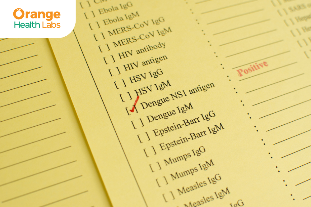 How to Interpret Dengue Test Results