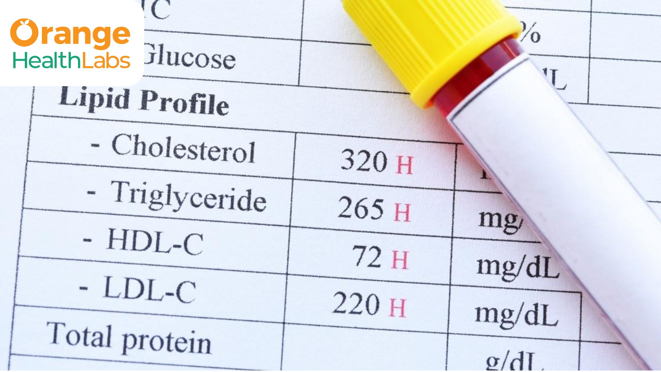 Cholesterol Management &amp; Lipid Profile Test: Debunking Common Myths