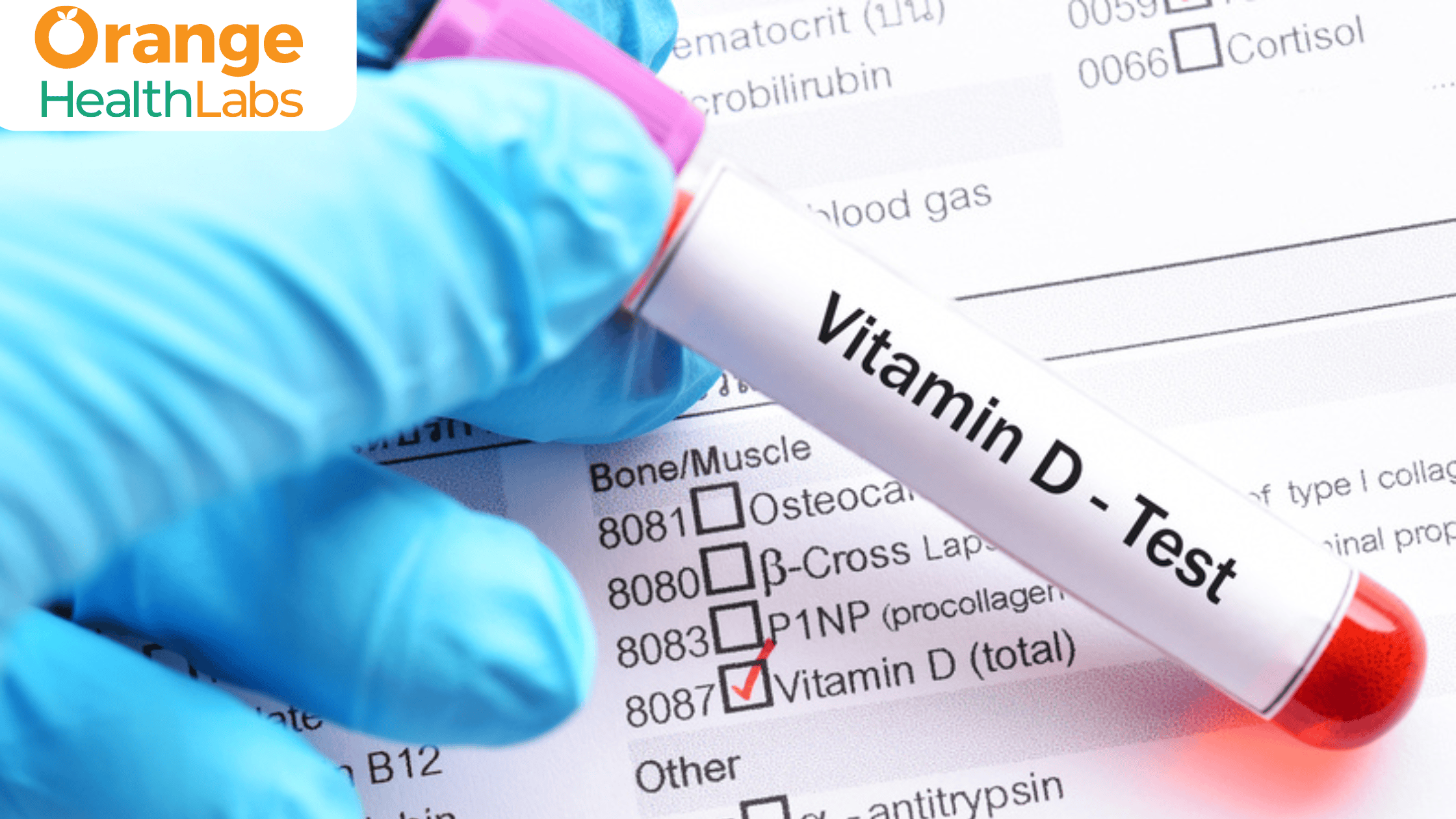 The Cost of Vitamin D Testing: Is It Worth